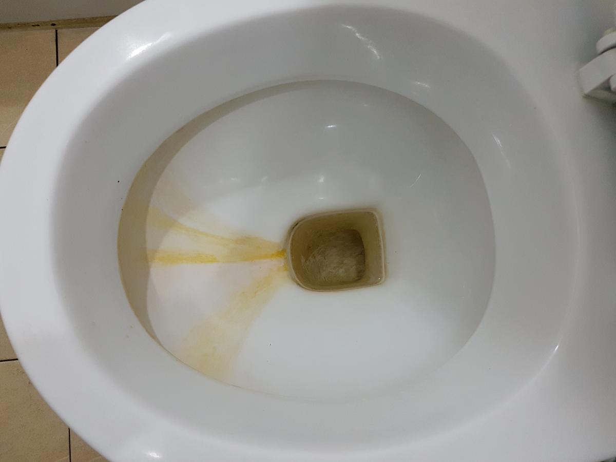 How to Remove Yellow Stains In Toilet Bowl